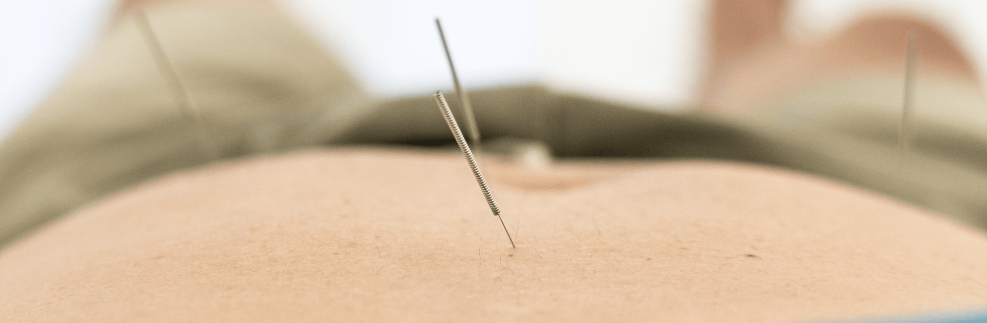 Alternative Remedies For Health And Wellness
